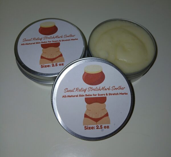 Sweet Relief StretchMark Soother balm with natural ingredients like shea butter, beeswax, and essential oils