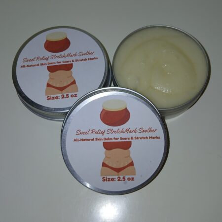 Sweet Relief StretchMark Soother balm with natural ingredients like shea butter, beeswax, and essential oils