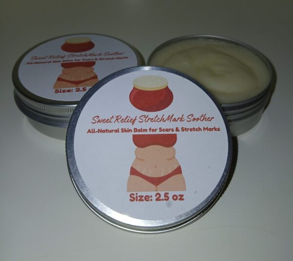 Sweet Relief StretchMark Soother balm with natural ingredients like shea butter, beeswax, and essential oils